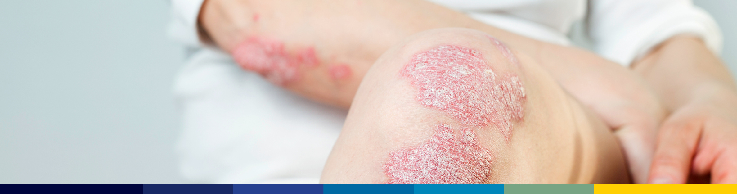 Update: First Humira® Biosimilar Now Available in U.S. hero image